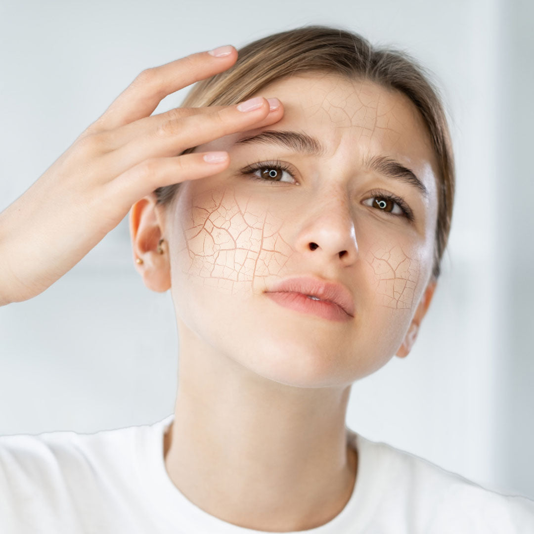 5 начина да се справим със сухата кожа през зимата